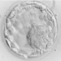IVF Embryo